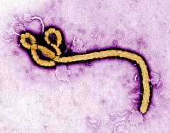 Image of the ebola virus.