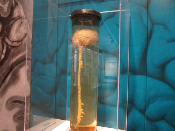 Tall cylindrical container shown in center foreground, with a yellow-hued brain and spinal cord suspended in liquid. Cylinder is in a clear display case, with a large blue-tinted closeup photo of brain folds as backdrop.
