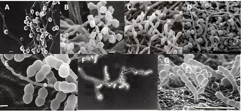 Microscopic images of various actinobacteria