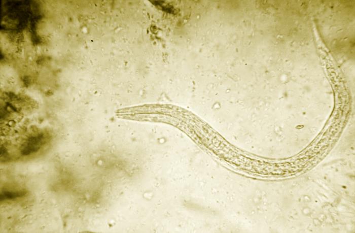 The image is a photomicrograph, taken through a microscope. It shows a hookworm larva.