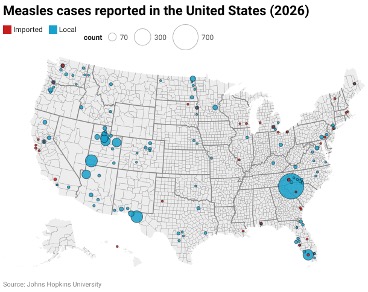 This is a map of the United States showing the number of measles cases reported in 2026. There are blue circles for local cases and red circles for imported cases. The size of the circles represent 70, 300, or 700 cases, with a large spread across multiple geographic areas.