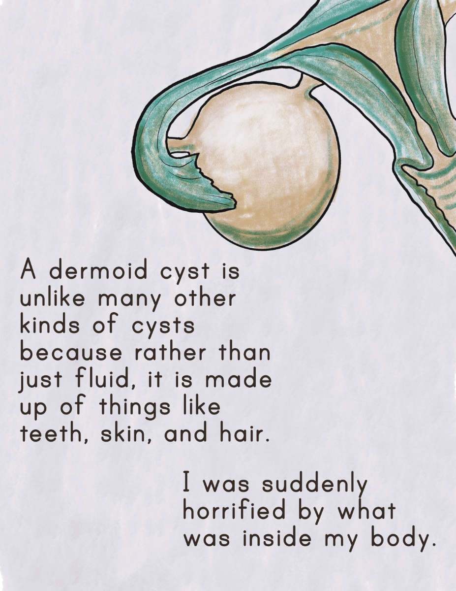 An illustration of a cyst on an ovary, drawn in yellow and teal. The comic narration text reads: A dermoid cyst is unlike many other kinds of cysts because rather than just fluid, it is made up of things like teeth, skin, and hair. I was suddenly horrified by what was inside my body.